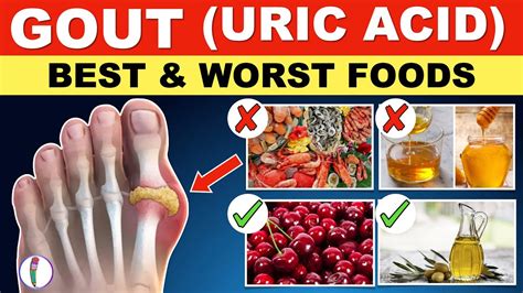 Take control of your health: Avoid deadly Uric Acid foods for a happier tomorrow