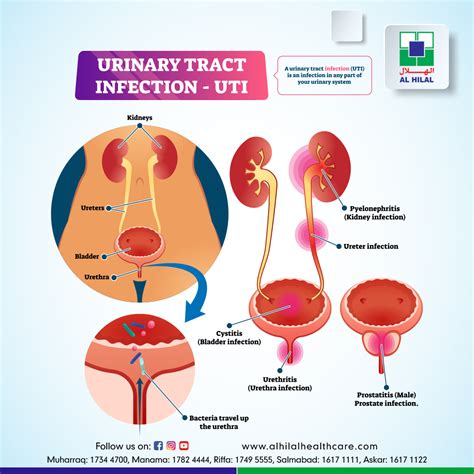 Urinary Tract Infection