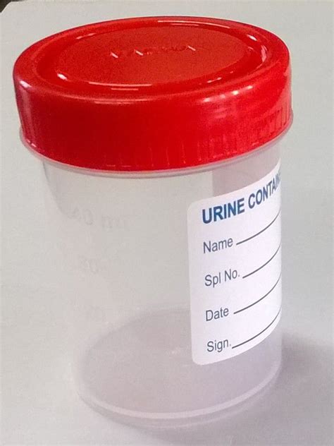 Urine Sample in Container