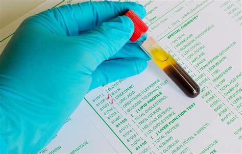 Urine Tests: Understand Function & Results Quickly.
