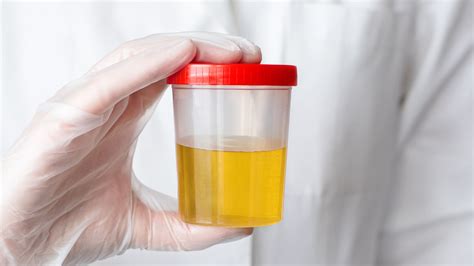 Urine sample collection