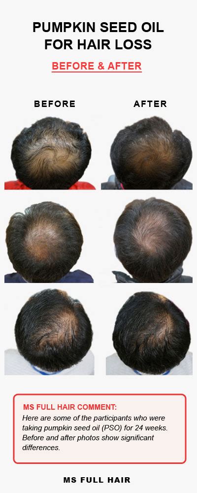 Using Pumpkin Seed Oil For Hair Growth: Application Methods