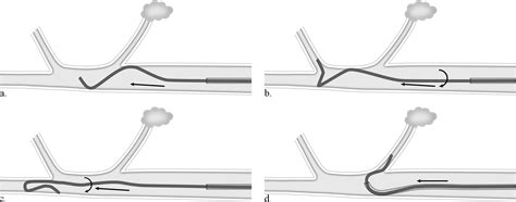 Using the Shepherds Technique