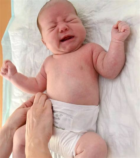 Tiny Tots Troubled by UTI: Understanding Urinary Tract Infections in Babies