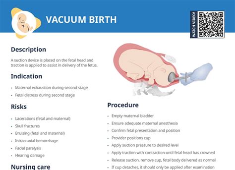 Vacuum Delivery: Safe Birth, Fast Recovery.