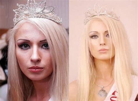 Valeria Lukyanova Before After Plastic Surgery Photos