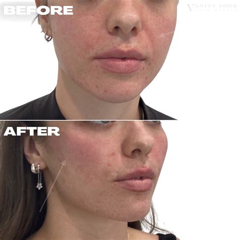 Get Ready to Glow with Vanity Look Skin Center's Luxurious Beauty Treatments