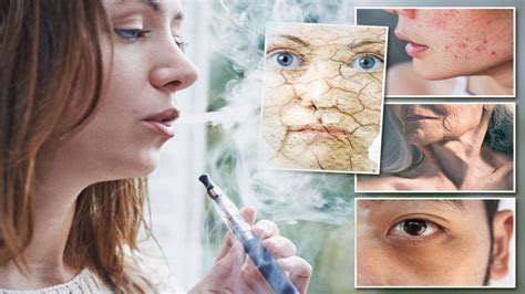 Vaping vs Skin Health: The Shocking Link Between E-Cigarettes and Skin Problems!