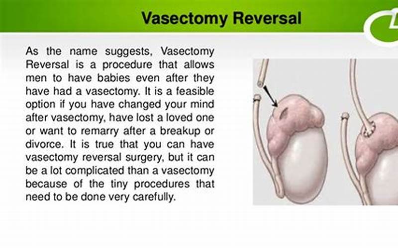 Vasectomy Reversal Candidate