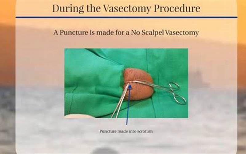 Vasectomy Scar Care