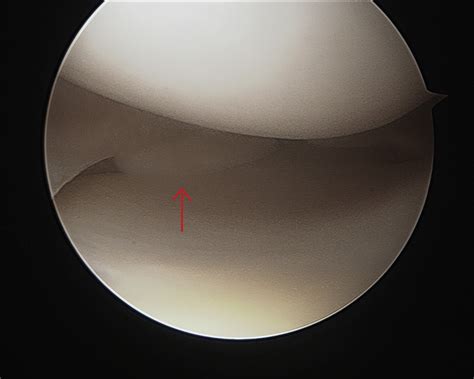 Choosing Your Viewing Portal