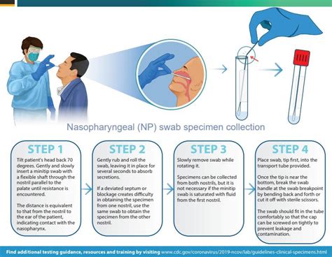Viral Respiratory Panel Test and interpretation