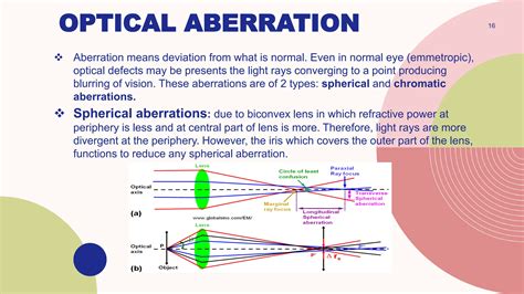 Vision Issues and Aberrations