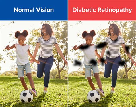 Vision Loss and Eye Issues (Retinopathy)