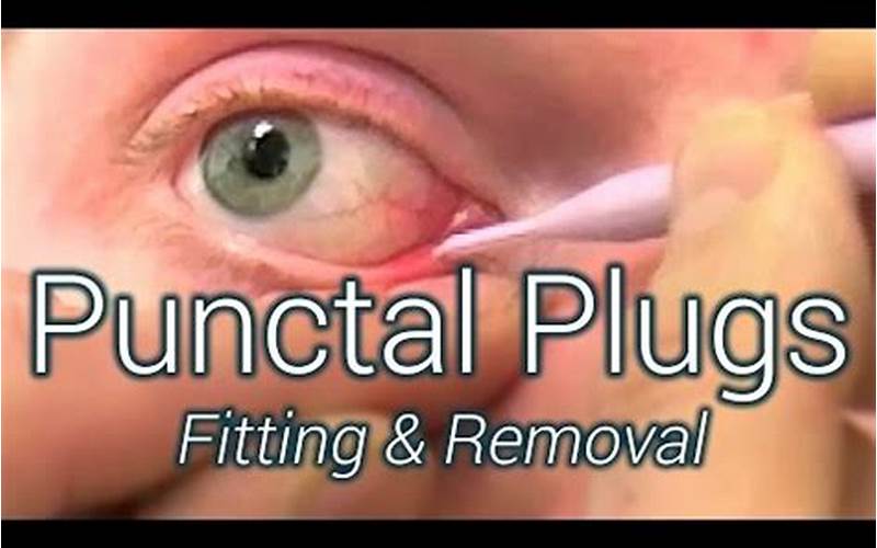 Visual Signs Of Punctal Plug Fallen Out