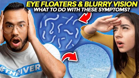 Visual Changes (Blurred Vision and Floaters)