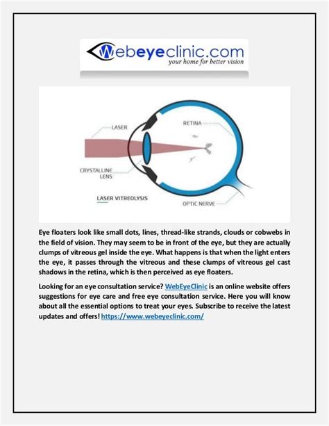The Procedure Step-by-Step