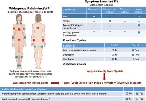 WPI and SSS: Decoding the Scales