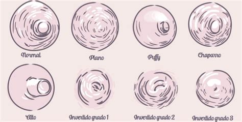 Warna Areola Normal & Kondisi yang Mempengaruhinya