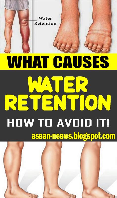 Water Retention