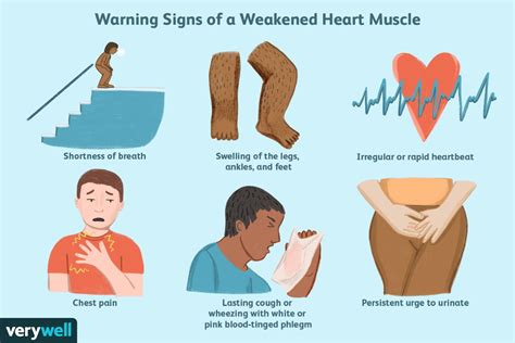 Weak Heart: Signs, Prevention & Solutions