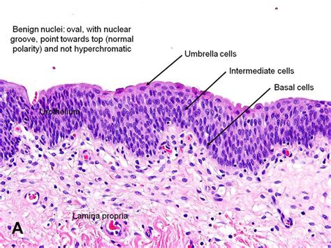 What Are Urothelial Cells?