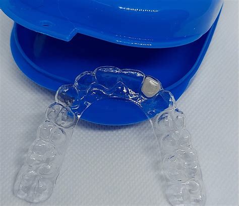 What Dental Code Is Used For An Essix Retainer?