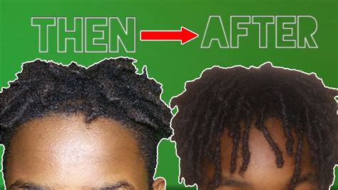 High Top Dreads 5 Tips To Make Your Dreadlocks Grow Faster!! YouTube