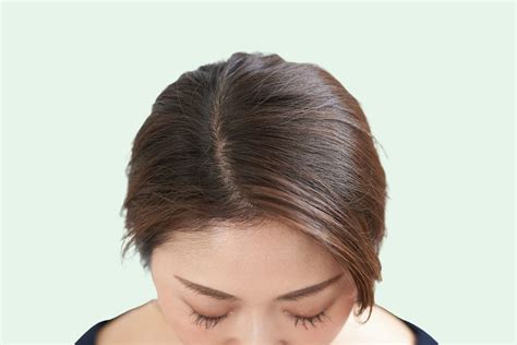 What About Sensitive Scalps