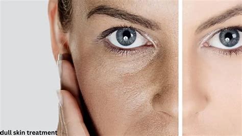 Unlocking the Mystery of Dull Skin: Causes and Remedies