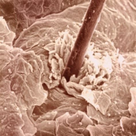 Unlocking the Enchantment of Skin Microscopy: Revealing the Wondrous World of Our Skin Cells