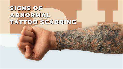 What Does Tattoo Scabbing Look Like