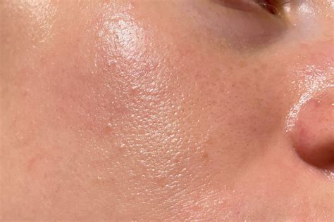 Discover How Textured Skin Affects Your Appearance