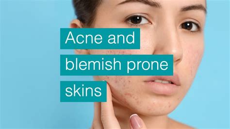Understanding Blemish Prone Skin: Causes and Solutions.
