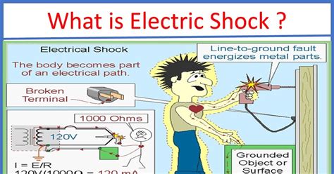 What Is Electric Shock