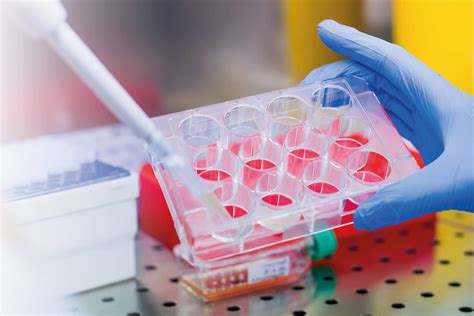 What Is In Vitro Analysis