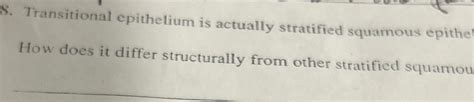 What Is Investigation How Does It Differ Structurally From Other Stratified