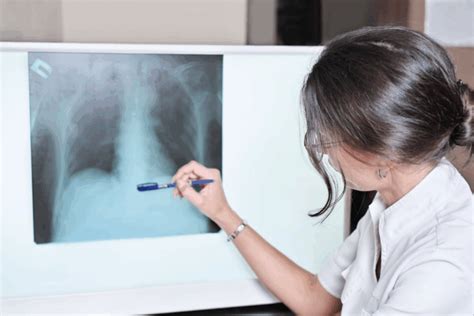What Radiologists Look For Key X-Ray Findings