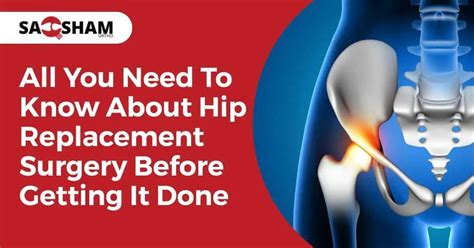 What You Need to Know Before Getting a Replacement