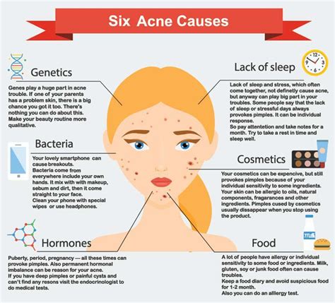 Acne Types, Symptoms, Causes & Treatments