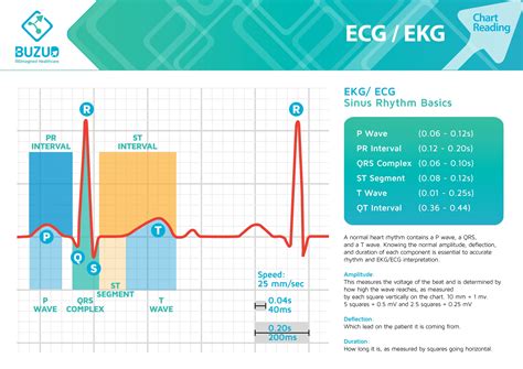 What is an ECG