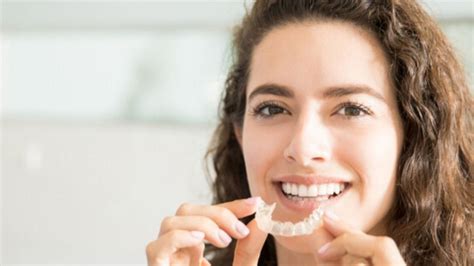 What to Consider Before Choosing Invisalign