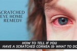 What to Do for a Scratched Eye