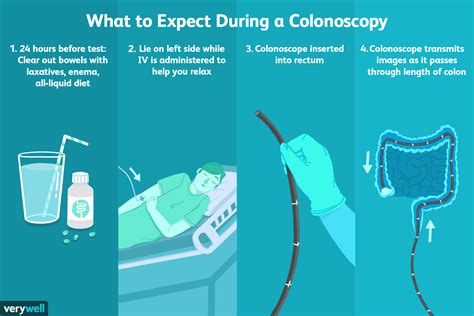What to Expect During Your Colonoscopy