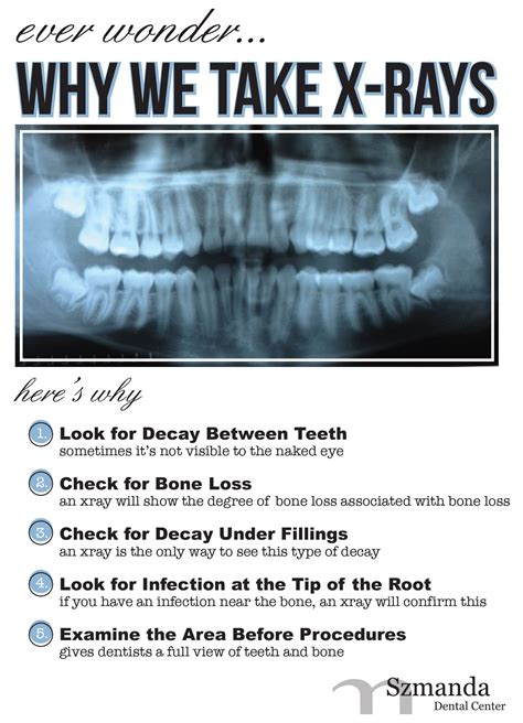 What to Expect During an X-Ray