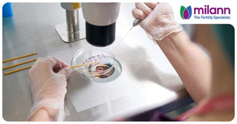 What to Expect During the Transfer