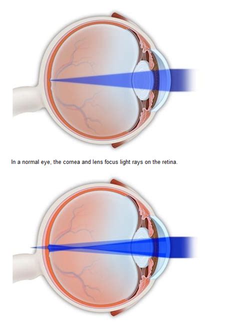 What to Look for in a Modern Eye Clinic in Round Rock