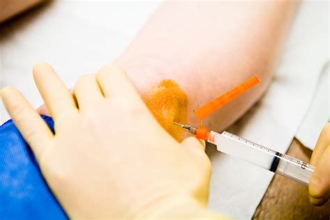 Process of receiving a cortisone shot at urgent care
