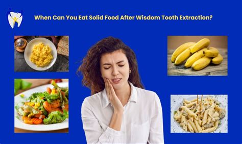 When Can I Eat Solid Food After Tooth Extraction? A Reddit Readers Guide to Eating After Dental Surgery