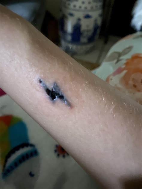 When Can I Scratch My Tattoo